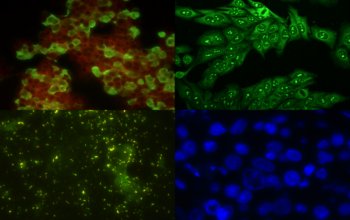 Nhuộm huỳnh quang